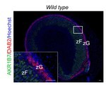 Des mutations de la voie WNT causent une insuffisance surrénalienne chez l’Homme